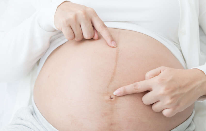 dark line on pregnant belly